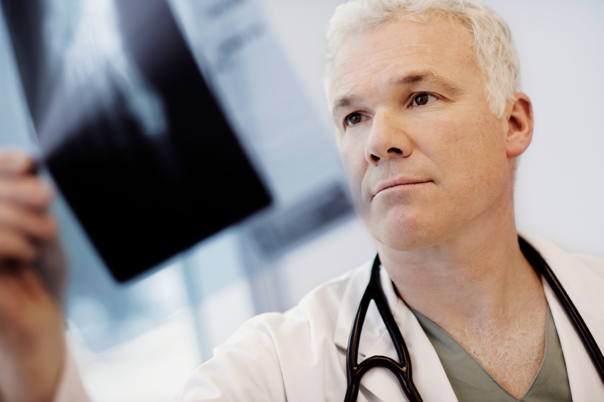 Should You Get a Bone Density Scan?