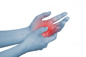 Rheumatoid Arthritis in the hand