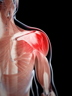 painful tendonitis in shoulder