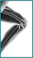 Knee